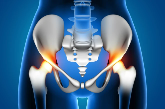 Best Hip Replacement Surgery: Find Your Perfect Surgeon in Ahmedabad