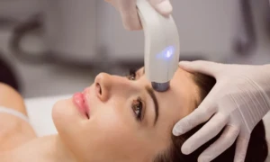 8 Reasons to Get an IPL Treatment