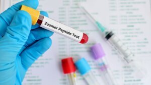 Zoomer Peptide Test
