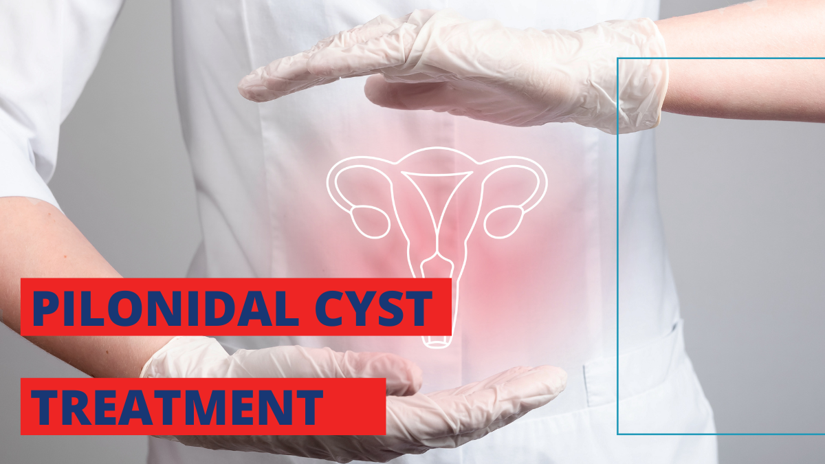 pilonidal cyst treatment