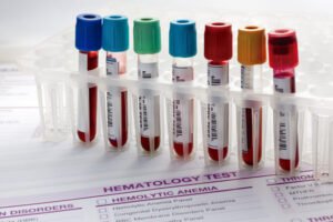 4 Benefits Of Private Lab Blood Services , Private blood tests Luton