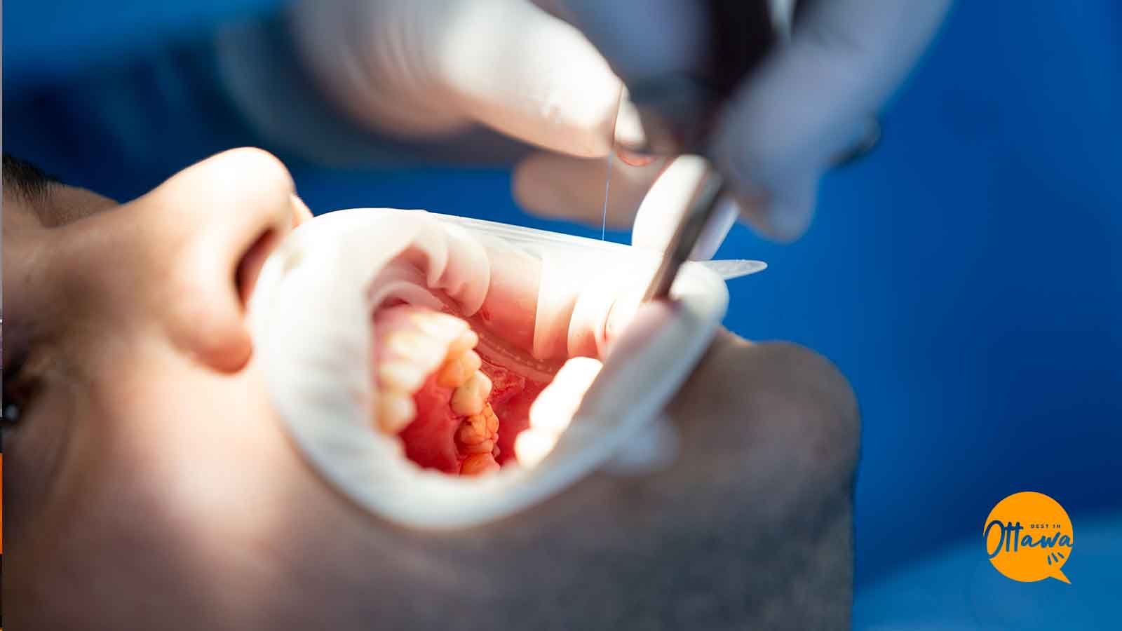 Downtown Dental Clinic: Transform Your Smile With Invisalign In Ottawa's Heart - TIMES OF RISING