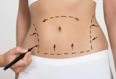 Tummy Tuck in Dubai: What to Expect Before, During, and After the Surgery